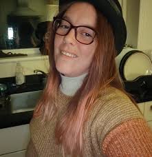 I was glassed a couple of years ago in a bar. Excuse the psoriasis which  was bad at the time. But this is the photos and recovery ones. Person was  charged for