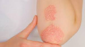 K Mexader Krem Ne İşe Yarar? Uzmanlardan Yeni Açıklamalar