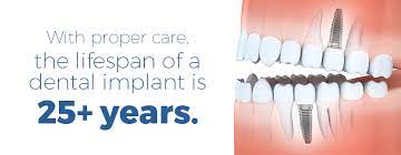 Instead of replacing natural teeth with fake teeth, implants replace the tooth roots and serve as a strong foundation for new permanent or removable dentures. How Long Do Dental Implants Last Az Family Dental