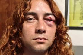 Gildo Insfrán's activists brutally attack liberal youths in Formosa