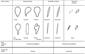 Maybe you would like to learn more about one of these? Ultrasonography Evaluation Of Infants With Alagille Syndrome In Comparison With Biliary Atresia And Neonatal Hepatitis European Journal Of Radiology