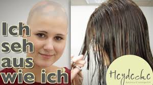 Kreisrunder Haarausfall Bei Frauen Ich Sehe Aus Wie Ich Dank Heydecke Natureline Echthaar Perucke Youtube