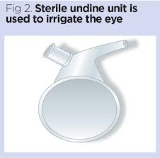 Image result for Eye Irrigation