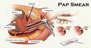 Ramai wanita malu dan takut. Papsmear Sakit La Athirahassin