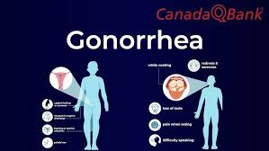 Image result for gonorrhea symptoms