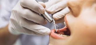 Biaya pasang behel, harga spesial bleaching, veneer, crown, bridge, tambal, cabut, pembersihan karang gigi, dan perawatan lainnya. Biaya Cabut Gigi Dan Hal Yang Harus Kamu Tau Tentang Cabut Gigi Fdc Dental Clinic