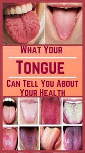 5 Warning Signs Your Tongue Could Be Sending About Your Overall Health Health Care 365 In 2021 Tongue Health Healthy Tongue Health