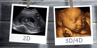 Obstetrics 3d 4d Ultrasound Helvetia Diagnostics Healthcare Center