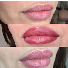 Before Immediately After Fully Healed In 2020 Lip Permanent Makeup Lips Shades Lip Color Tattoo