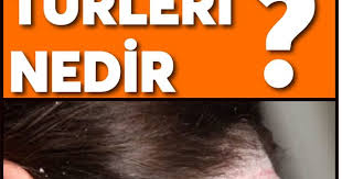 Sedef Hastaliginin Turleri Nelerdir Movie Posters Movies
