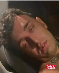 Photographer shares personal story of brain damage and finds inspiration in  tree root knots