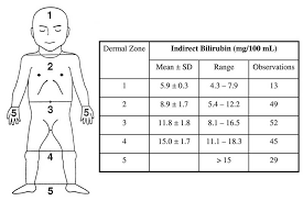 5 kramer scale jaundice in newborn bilirubin level chart