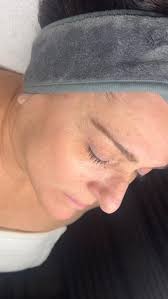 Merry Christmas and Happy New Year family&friends, from Glass Skin  Aesthetics! 🎊, Devon,, Aesthetician & Owner