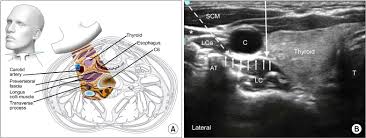 Check spelling or type a new query. A Cross Section Of The Neck At The Sixth Cervical Vertebral Level Download Scientific Diagram