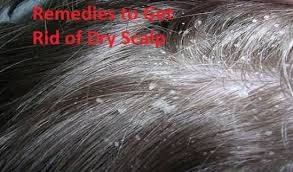 While you figure out the cause, try not to scratch your scalp. How To Get Rid Of Dry Scalp Ways To Heal Dry Scalp Home Remedies For Dry Scalp Treat Dry Scalp At Home Tea T Dry Scalp Dry Scalp Remedy Thick Hair