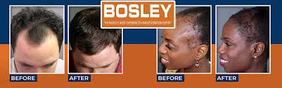 Bosley is located in beverly hills, california. Casting Men Women With Thinning Hair For Paid Product Trial Market Study From Top Hair Restoration Company Bosley Infolist