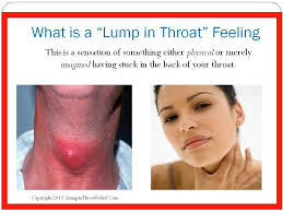 You might feel like food is sticking in your throat. Lump In Throat Feeling How To Get Rid Of Globus Hystericus Lump In My Throat Sensation Youtube