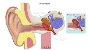 Like pp mentioned, as long as you drain/clean their ears after baths and they aren't submerged under the water for long periods of time they will be fine. Ear Infections Ear Institute Of Texas And Voice Swallowing Institute Of Texasear Institute Of Texas And Voice Swallowing Institute Of Texas