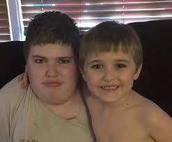 Allergies pose constant challenge