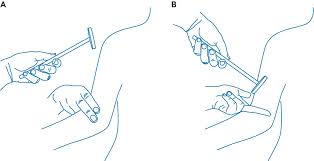 Image result for Reflex Exam