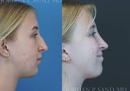 Welcome to Sand Plastic Surgery 2024!