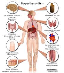 American association of clinical endocrinologists has reported that thyroid disease affects more than. Hair Loss Thyroid Everything You Need To Know Ds Healthcare Group