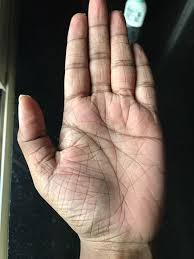 Of course, each line will have their special and unique meanings. What Does Having Too Many Lines On Your Palm Indicate Quora