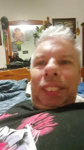 stop talking about my teeth