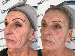 Ana Chamorro Estética...