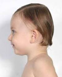 When in doubt, layered hairstyles and cuts for long hair are easy and simple to get, but look cute and fashionable for all occasions. Daily Hairstyles For Reducing Reclining Hairline Female Plagiocefalia Casi In Aumento Osteopatia Andrea Nitri A Buzz Cut Is Any Of A Variety Of Short Hairstyles Usually Designed With Electric Clippers Malahnganu