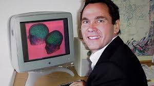 UCSD study may suggest autism's cellular basis