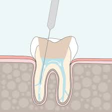 Q&a boards community contribute games what's new. Endodontics Frankfurt Dentist