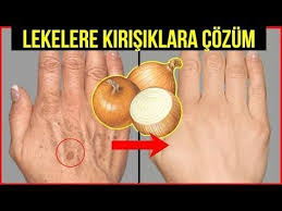 Hatice Kahveci Adli Kullanicinin Yuz Maskesi Panosundaki Pin 2020 Organik Cilt Bakimi Saglik Urunleri