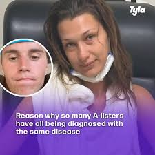 A number of celebs have spoken out about it 😮