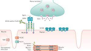 Myasthenia gravis is an autoimmune disease of the neuromuscular junction for which many therapies were developed before the era of evidence based medicine. Myasthenia Gravis Nature Reviews Disease Primers