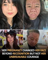 Rob fonts face swells so quickly it seems like. Or am i trippin?