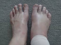 ライブドアブログ