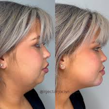 Jaclyn MSN, APRN, FNP-C💉 (@injectorjaclyn) • Instagram photos and videos