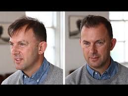 The men's hairstyle options for thin hair depends on your preference. Men S Hairstyle Tutorial Thin Or Thinning Hair Youtube