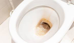 We did not find results for: Brown Stains On Toilet 4 Ways To Get Rid Of Limescale In Toilet Express Co Uk