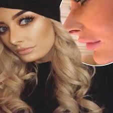 Love Island S Chloe Crowhurst Acknowledges Unexpected Cosmetic Surgery Decision As She Confesses To Lip Filler Mistake Ok Magazine
