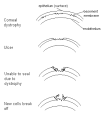 People at risk for corneal ulcers include those who cataracts often progress slowly, but they can start to affect your vision over time. Veterinary Ophthalmologist In Montreal Indolent Corneal Ulcer