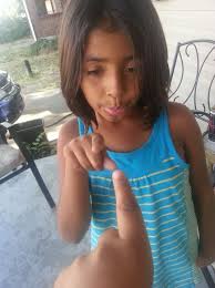 This is my daughter Sara. She has NF 1. She has migraines and leg pains.  She has a plexiform