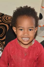 Another common cause of tooth discolouration is the use of tetracycline  based antibiotics in children under 8 years (during tooth development)  Tetracycline binds to calcium and tooth staining can range from bluish