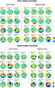 Frontiers | Using Brain Oscillations and Corticospinal Excitability to  Understand and Predict Post-Stroke Motor Function