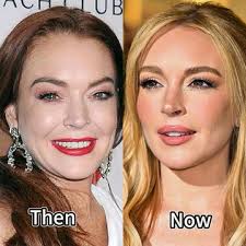 Lindsay Lohan Now Real