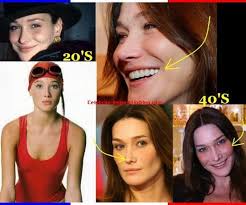 Check spelling or type a new query. Carla Bruni Chirurgie Esthetique Plastic Surgery Sarkozy News Revue De Presse Anti Sarko D Day 6 Mai 2012 Le Debarquement De Sarkozy