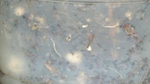 Connected to my feces, seen small worms wiggling in the water, as well as white worms tangled in a ball. What Are These Transparent Worms