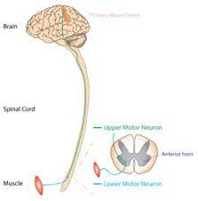 It is characterized by progressive degeneration of nerve cells in the spinal cord and brain. Amyotrophic Lateral Sclerosis Wikipedia