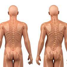 Make sure you use the versions of the libraries i use in the video, this is probably the source of any of your problems. Scoliosis How To Treat A Curved Back